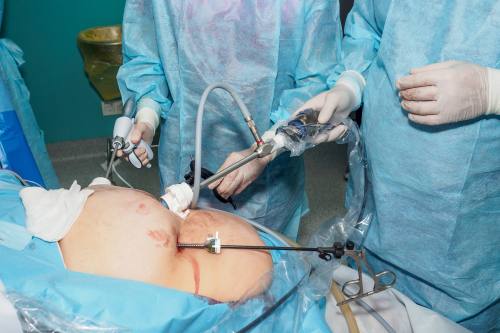 Reconexión de Tránsito Intestinal